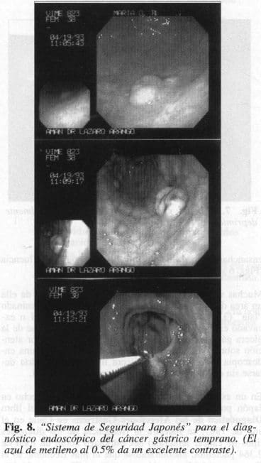 Sistema de Seguridad Japonés Sistema de Seguridad Japonés