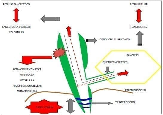 Mala unión biliopancreática