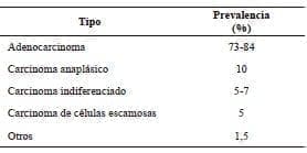 >Tipos de cáncer en pacientes con quistes del colédoco