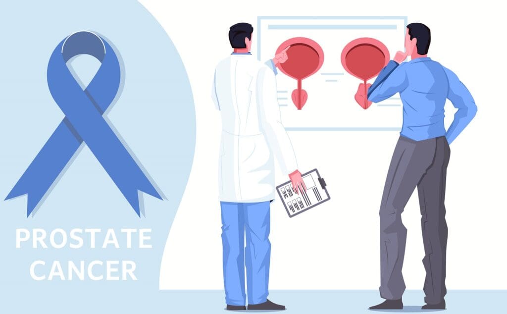Tratamientos para el cáncer de próstata