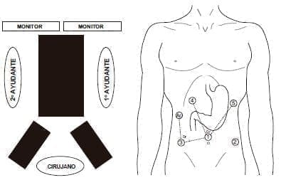 Tempo Quirúrgico Abdominal