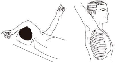 Tiempo quirúrgico torácico