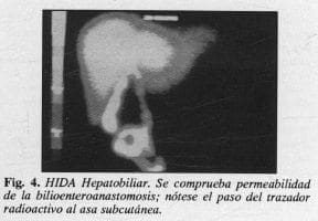 HIDA Hepatobiliar