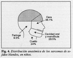 Sarcomas de tejidos blandos