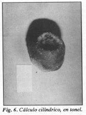 Cálculo cilíndrico