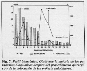 Colocación de Lasprótesis endobiliares