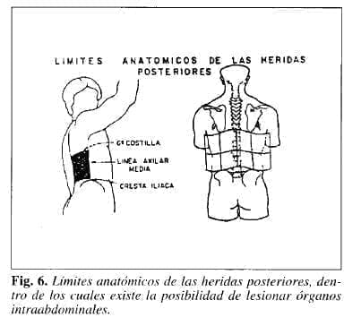 Lesion de órganos intraabdominales