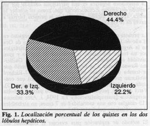 Quistes en los dos lóbulos hepáticos