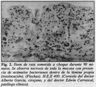 Necrosis de toda la mucosa