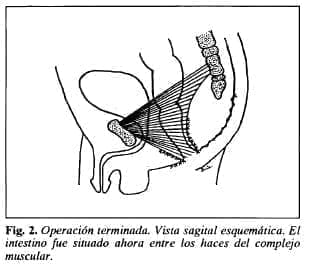 Vista sagital esquemática