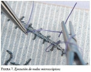 Nudos microscópicos
