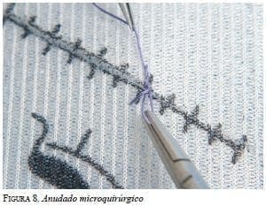 Anudado microquirúrgico