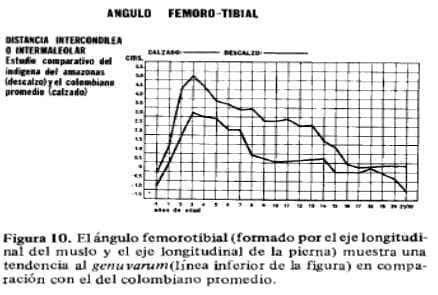 Angulo Femoro Tibial