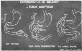 Experimentos de Delaney