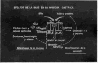 Efectos de la bilis