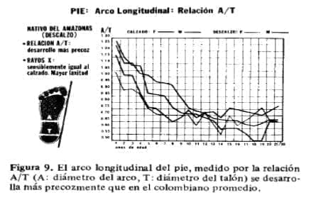 Pie arco longitudinal