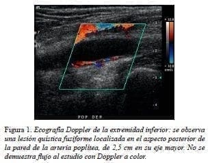 Ecografía Doppler de la extremidad inferior