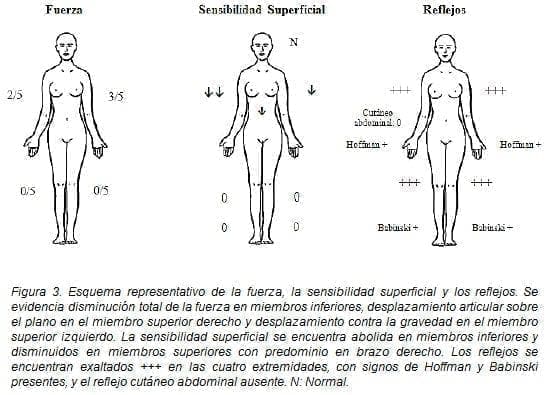 La Fuerza, la Sensibilidad Superficial y los Reflejos