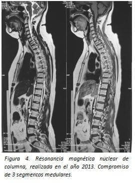 Resonancia Magnética Nuclear de Columna