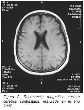Resonancia Magnética Nuclear Cerebral Contrastada