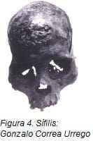 Sífilis: Gonzalo Correa Urrego