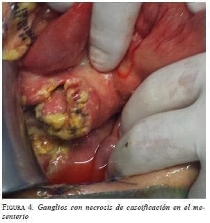 Ganglios con Necrosis