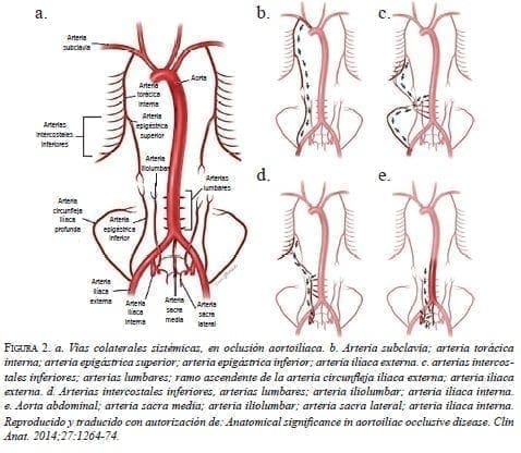 Vías Colaterales Sistémicas