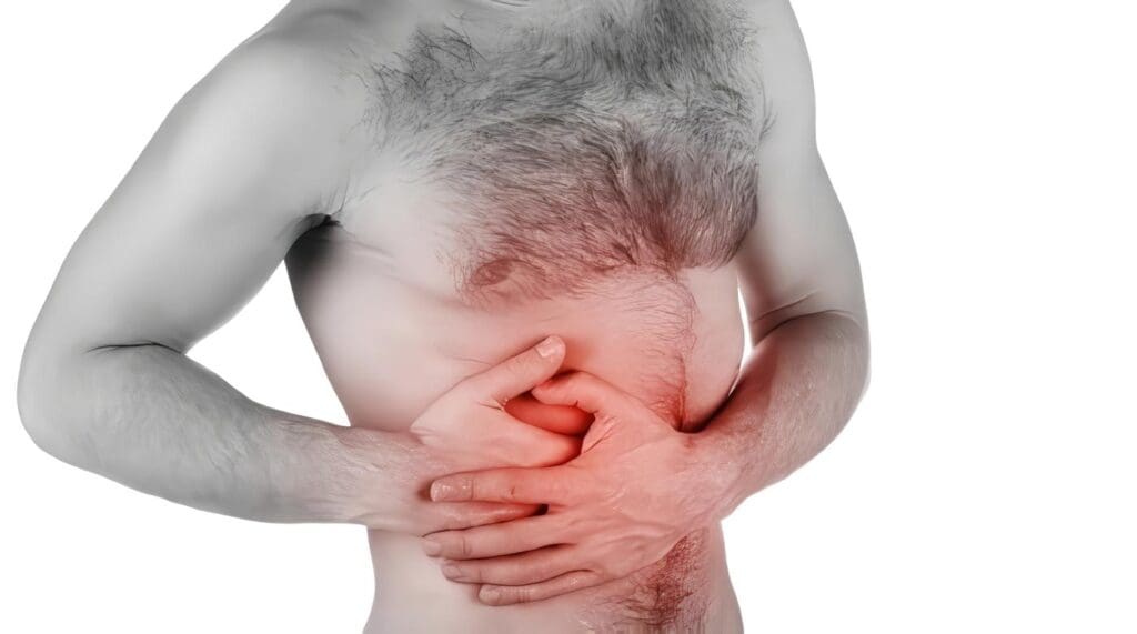Medicina, Enfermedad Diverticular del Colon