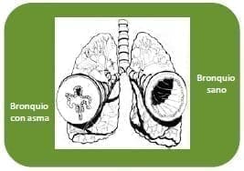 Bronquios