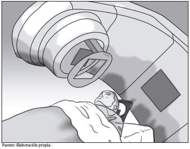 Equipo de radioterapia