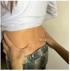 Localización del proceso espinoso L5 Localización del proceso espinoso L5