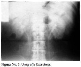 Urografía Excretora