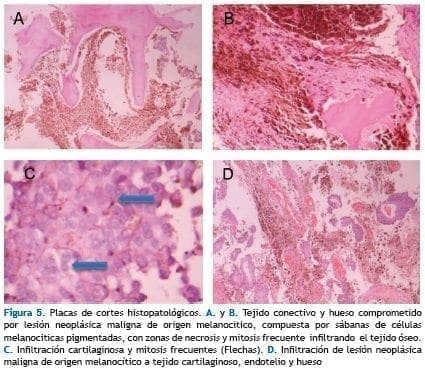 Placas de cortes histopatológicos Placas de cortes histopatológicos