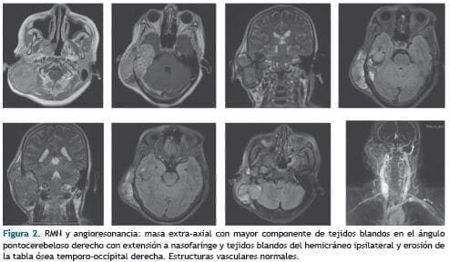 RMN y angioresonancia RMN y angioresonancia
