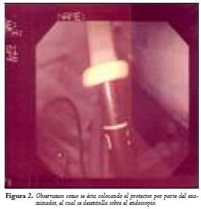 Endoscopio con el protector Endoscopio con el protector