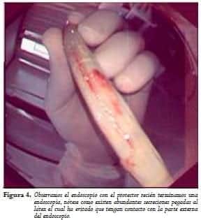 Endoscopio con el protector  Endoscopio con el protector