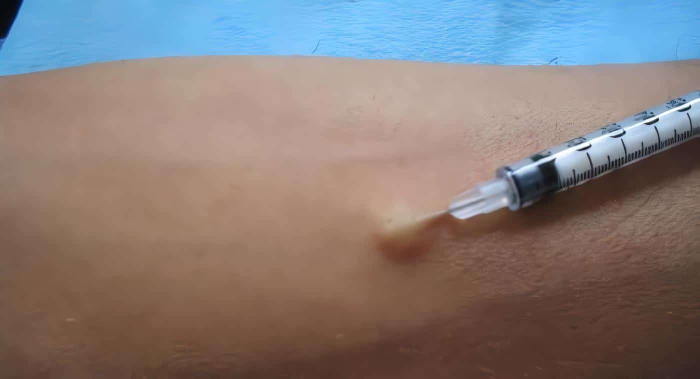 Prueba de penicilina para prevenir reacciones alérgicas severas