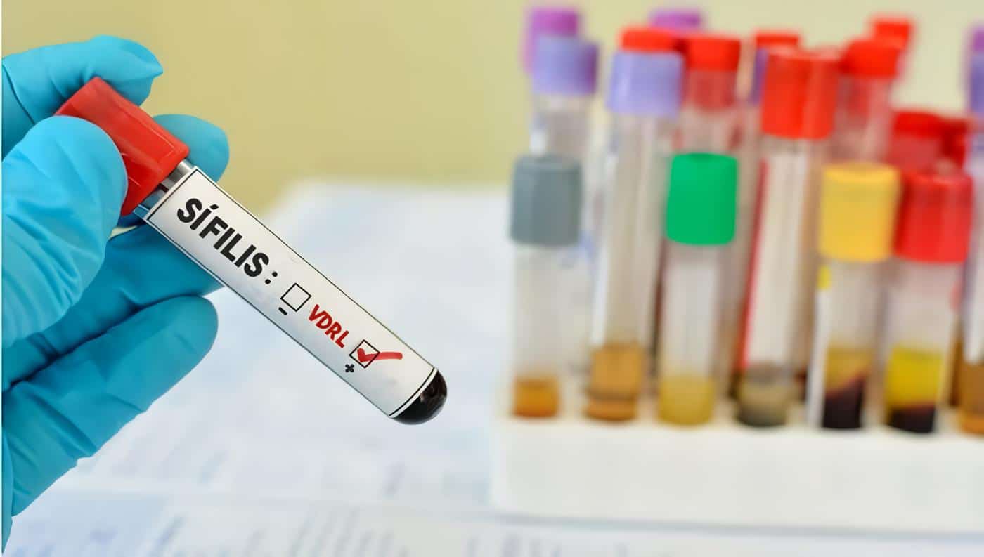 Manejo de la reinfección en mujeres con sífilis gestacional