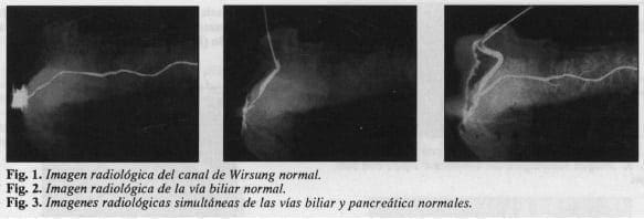 Canal de Wirsung normal, vías biliar y pancreática normales