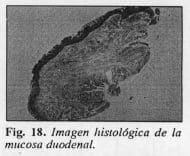 Mucosa duodenal Mucosa duodenal