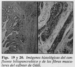 Fibras musculares del esfínter de Oddi Fibras musculares del esfínter de Oddi