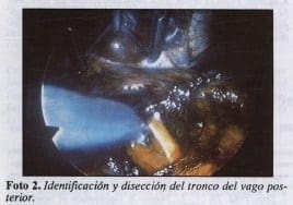 Identificación y disección del tronco del vago