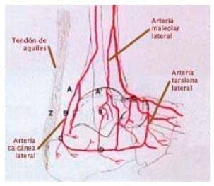Fracturas de calcáneo intraarticulares Fracturas de calcáneo intraarticulares