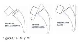 Listesis progresa