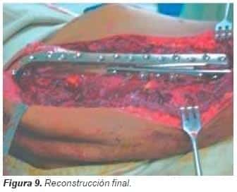 Reconstrucción final Reconstrucción final