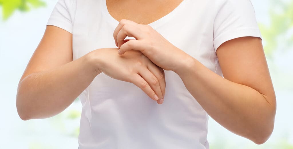 Dermatitis Atópica