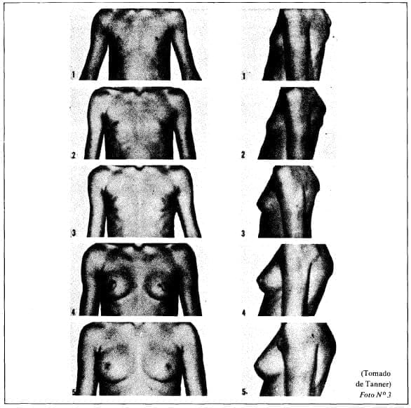 Estudios epidemiológicos sobre maduración sexual Estudios epidemiológicos sobre maduración sexual