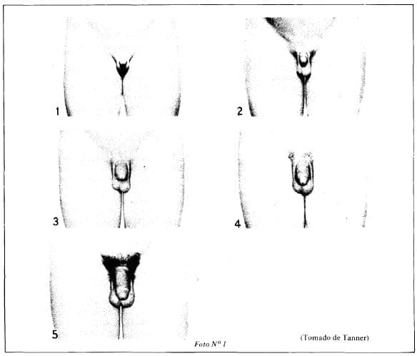 Sistema de registro de la maduración sexual