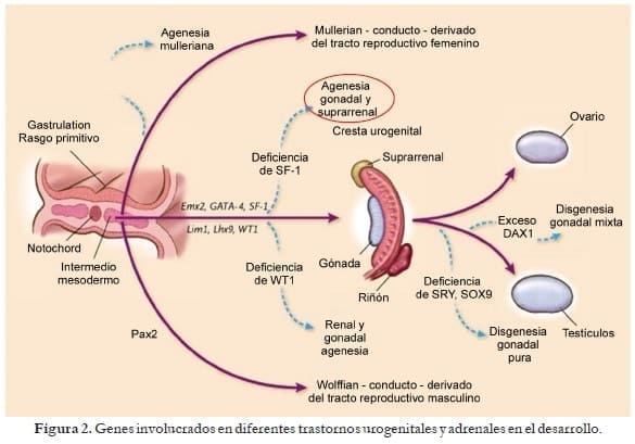 Trastornos urogenitales en Hiperplasia suprarrenal congénita Trastornos urogenitales en Hiperplasia suprarrenal congénita