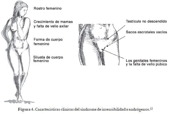 Características clínicas del síndrome de insensibilidad a andrógenos Características clínicas del síndrome de insensibilidad a andrógenos